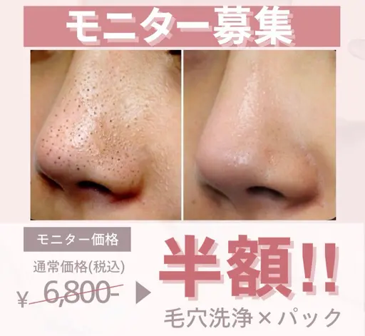 【先着10名・半額モニター】つるすべ毛穴洗浄コース｜通常¥6,800→¥3,400！今すぐ予約で確保を