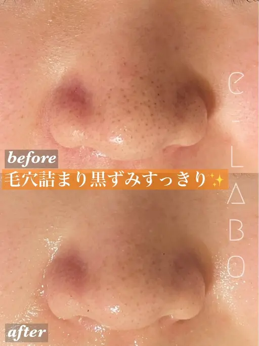 【平日限定】毛穴洗浄🫧※現金のみ