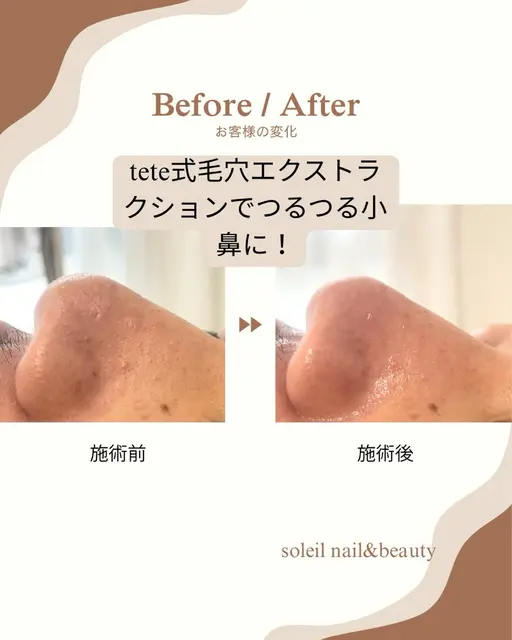 🌷毛穴すっきりお試しコース🌷