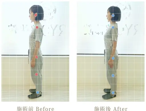 美姿勢矯正コース(スマホ首、巻き肩、猫背、肩こり、腰がつらい方、姿勢が悪くカラダの歪みが気になる方にオススメ)