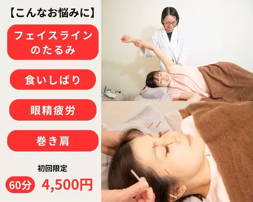 美容鍼を試したい貴女に　速攻小顔コース(指圧マッサージ＋美容鍼)
