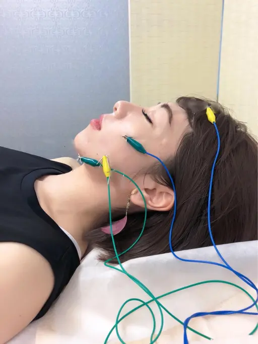 テレビにも出た話題の施術法のお顔に電気を流す美容鍼を通常6000円→4000円