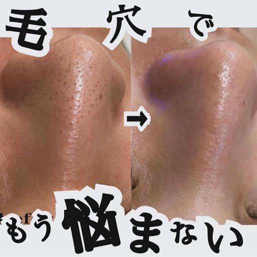 毛穴吸引スッキリ💆‍♀️✨ミニモ限定