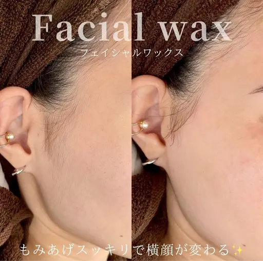 本日‼️フェイシャルWaxモデル💆 注意事項詳細を必ずご確認下さい
