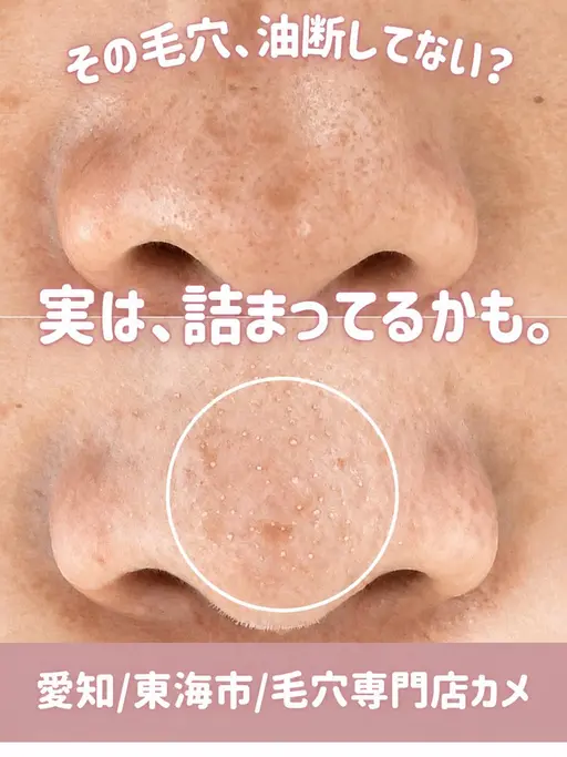 【8月限定】毛穴つや肌コース(ヘッドマッサージ付)/毛穴の黒ずみ、ザラつき気になる方におすすめです/お着替えなし