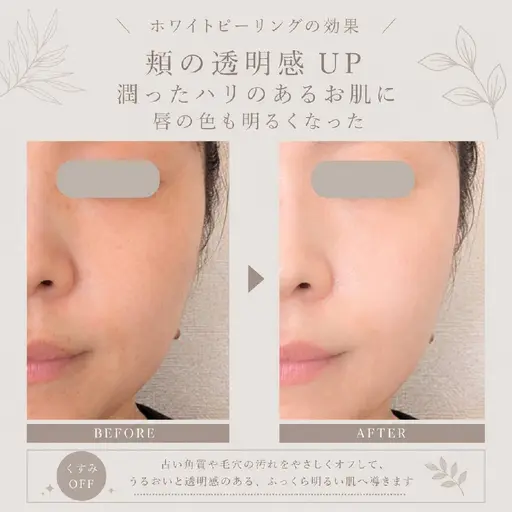 【ホワイトピーリング】夏の肌は"落とすケア"が大切です♪