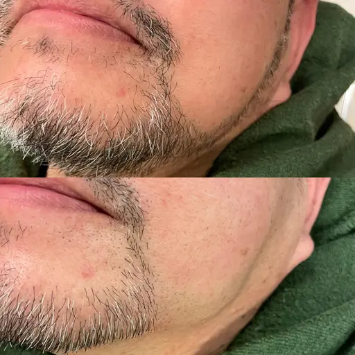 💈眉毛アイブロウ+シェービング(お顔剃り)¥3,300 眉毛のデザイン、ヒゲのデザイン、お任せ下さい