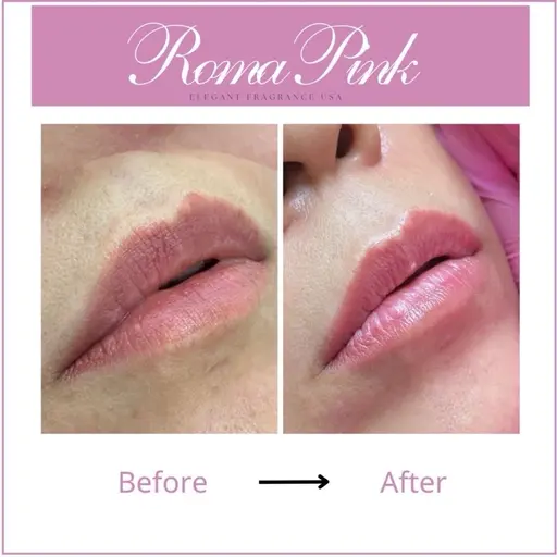 【韓国最先端ローマピンク】RomaPinkリップ◆ カウンセリング