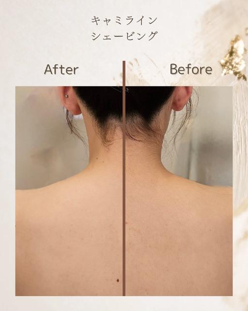 【顔/背中】顔&背中上段シェービング
