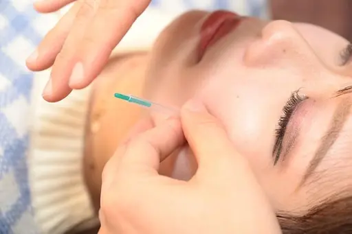 【少ない刺激で小顔効果🌟】美容鍼+首肩リンパマッサージ