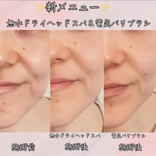 脳疲労回復!睡眠美容!無水ドライヘッドスパ(20分)+電気バリブラシ(10分)(男性可能)