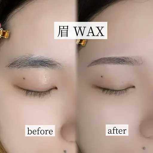 眉ワックス脱毛