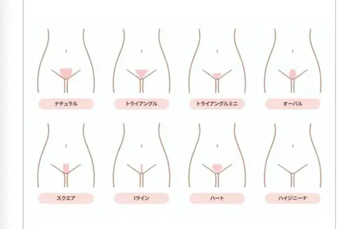 【LADY's】みんなこっそりやってる?!VIO脱毛!でもやっぱり恥ずかしいかったり痛みが心配…お得にお試ししちゃお♪
