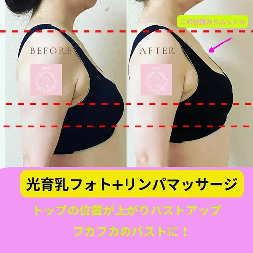 メスを入れない豊胸!光育乳フォトバスト➕マシンを使ってリンパ流し【バストアップ・美乳】