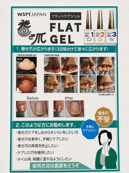 【巻き爪の方にオススメ✨️】巻き爪ケアフットネイル(オフ無料)【ワンカラー】