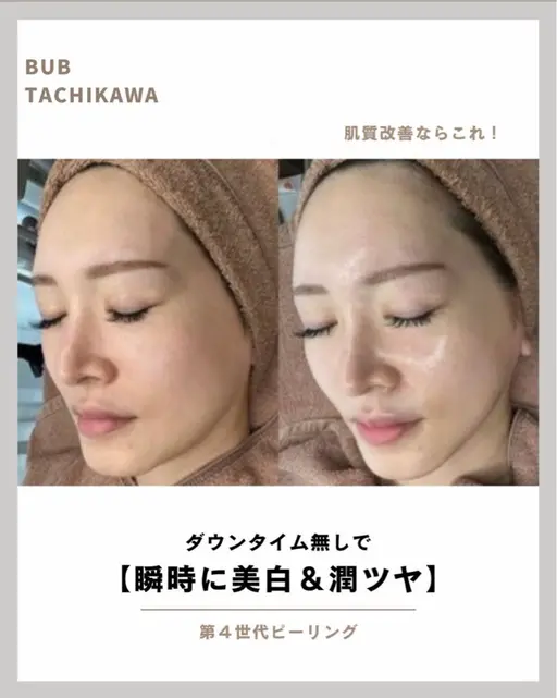 【くすみ・ニキビ・乾燥を全部解決】ララピール韓国肌管理|透明感+ハリ+潤いを1回でチャージ