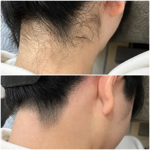 うなじWAX