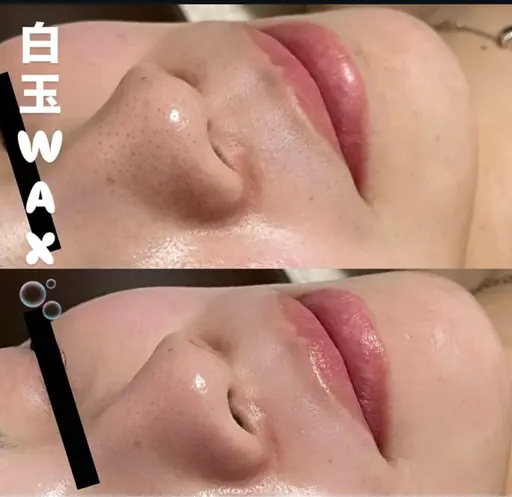 『白玉WAX』天然美容成分100%のスキンケアワックス☺︎産毛・角質・顔ダニを取り除くことで様々なスキンケア効果が！