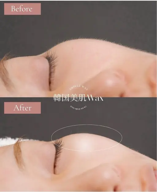 【男性・女性OK！レッスンモデル募集中】〈初回〉平日ミニモ限定✨韓国美肌WAX(フェイスWAX脱毛)¥1,000