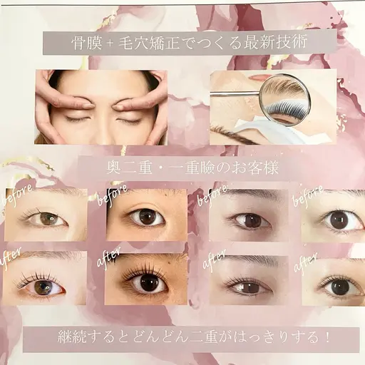 眼精疲労むくみに⭐️目元の美容整体アイストレッチ💆🏻♀️