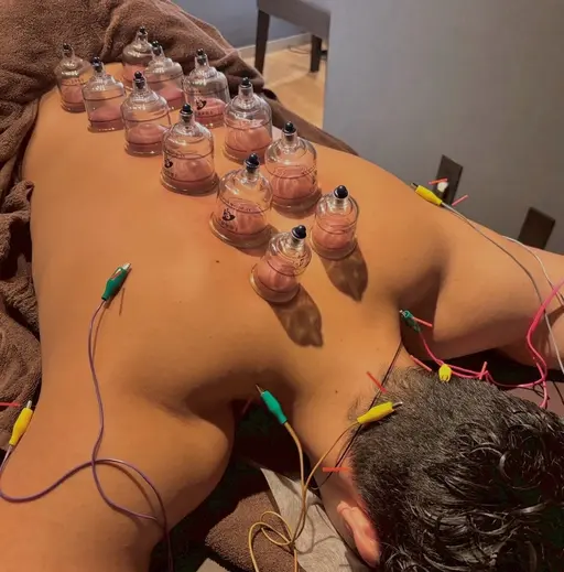 【人気No.1】自律神経調整鍼🦔🪡睡眠障害/疲れが取れない方/慢性的な首肩凝り/呼吸が浅い方にオススメ💆♀️✨
