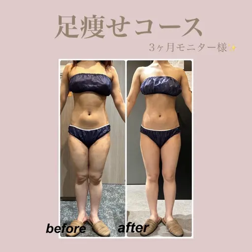 29日〜31日ご来店限定🤍5月限定🤍薄着になる前に🔥 むくみ・疲労感・ライン崩れ徹底ケア