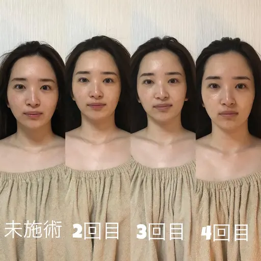 【脳洗浄®︎90分】口コミ投稿•ビフォーアフター撮影掲載•4回ご来店OK(2ヶ月以内消費)モニター様特別価格で募集中🌈