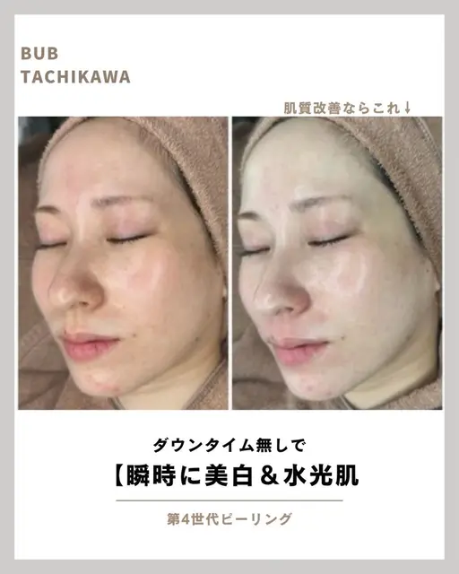 本日限定❣️特別価格🫧🍑 ウルツヤ透明感肌へ◎艶肌リニューアルケア