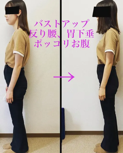 🌸残1名！🌸華奢な20代限定インスタSNSモデル！ ■猫背/巻き肩/腹圧型ポッコリお腹/肩こり※編集で眼は消します