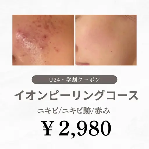 【U24・ミニモ学割】 1日2組限定🌸ニキビ肌のために作られた刺激ゼロピーリングコース