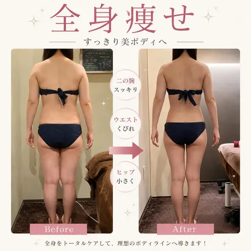 ✨【結果重視】痩せタイプ分析付✨７工程全身痩身90分🌻むくみ・肩こり・セルライト・ボディラインを徹底ケア💛￥3980