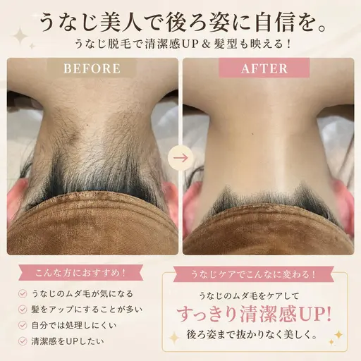 シルバーウィーク限定【うなじ脱毛】🪽🫧🤍写真映📸レイビス独自✨️後ろ姿美人🧚🏻⸝⋆