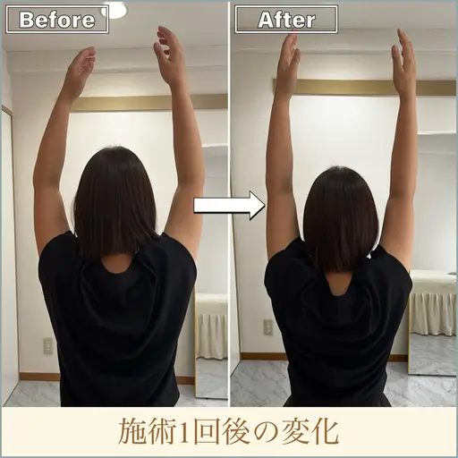 【🍃美容整体60分】首肩集中ボディケア🍃 首や肩まわりを中心にケアする人気メニュー✨PC・スマホ利用が多い方はぜひ◎