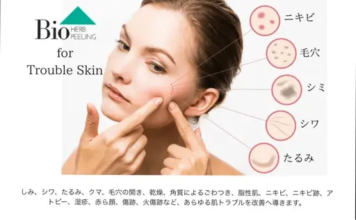 ミニモ限定 価格 剥離あり!人気No1 国産100%天然ハーブピーリング