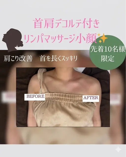 ❤️🔥首肩スッキリ❤️🔥筋膜リリース×リンパマッサージ×美顔器小顔施術100min ¥24,200→¥5,500