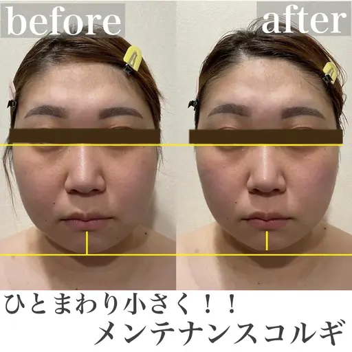 ✨🌷リフトアップ小顔コース🌷✨【小顔コルギ+ボディコルギ 60分】たるみ/ほうれい線/肩こり/首こり/肩甲骨
