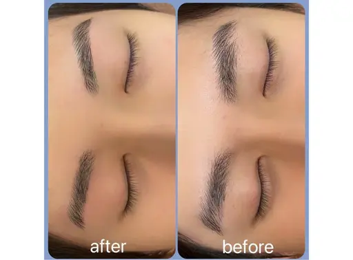 美眉WAX脱毛✨️