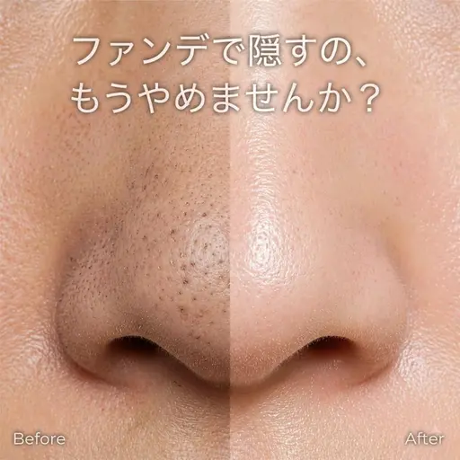 【黒ずみ/角栓崩壊】毛穴洗浄でつるん透明肌へ◎90分⭐️¥4980
