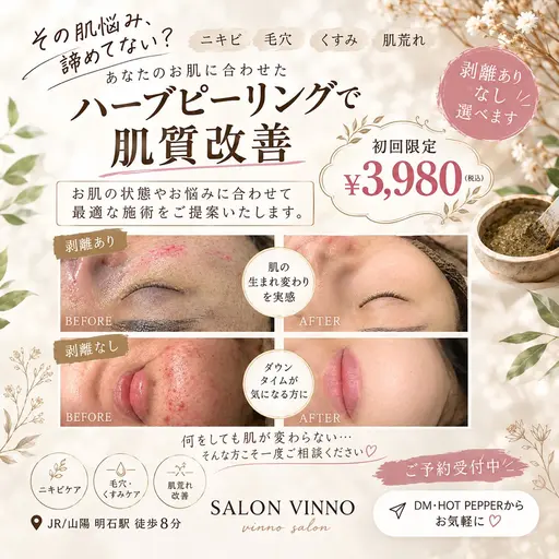 【初回限定】剥離なしハーブピーリング🌿