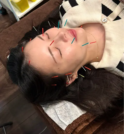 【シュッと✨ﾌｪｲｽﾗｲﾝ形状記憶✨】リフトアップ美容鍼×本質ケア→ フェイスラインのもたつき・むくみ・が気になる方へ