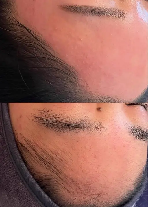 【透明感UP！】艶肌フェイスwax脱毛＋高保湿パック　眉なし