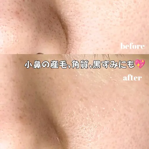 《10月5名限定》フェイスWAX💖産毛や古い角質を除去しツルツル艶肌へ🧏🏻♀️✨