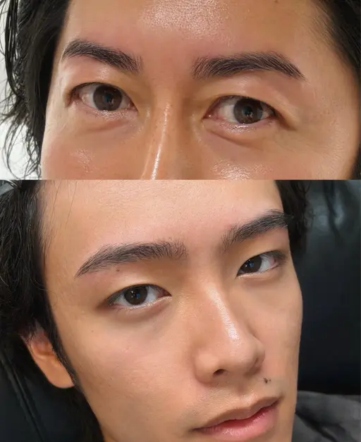 【📷お顔フル撮影可能モデル】【🔴1ヶ月半以上お手入れしていない方】(wax・間引き・パーマ) ⚠️他、施術条件あり