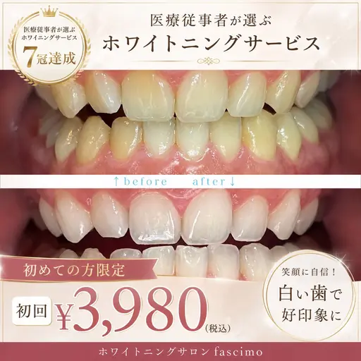 【人気No.1】ホワイトニングサービス7冠達成のサービス👑を初回¥3,980で体験!初めての方にもおすすめ✨