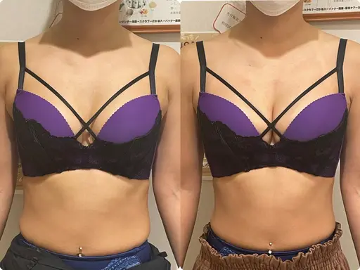 U22🤎初めてでも安心マシュマロバスト☕🍩レイビスオリジナル育乳メゾット!!巻き肩、猫背にも◎