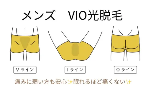 🥸メンズ脱毛【VIO】