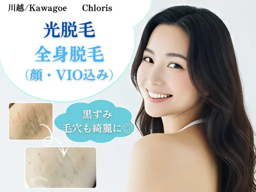 全身光脱毛(顔+VIO込) 全部まるごと!憧れの全身ツルスベ肌を最短で実現