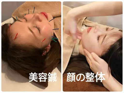 【おすすめNO.1❤️‍🔥】美容鍼×顔の整体→エラ張り、顔のゆがみ、左右差を整える✨