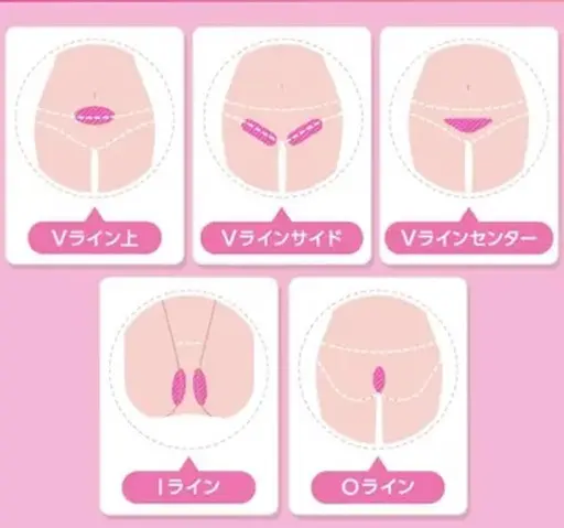 💫VIO脱毛💫2段階シェービング付❣️最新機器で早く効果を出したい方必見✨