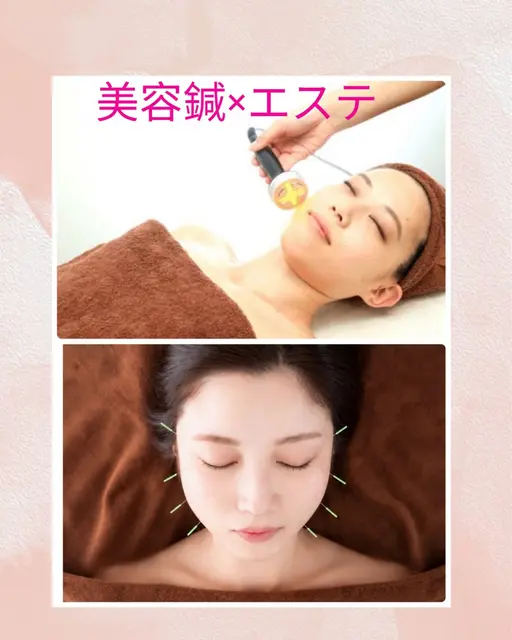 【先着3名様】✨美容鍼×エステモニター 100分✨ビフォーアフター写真掲載にご協力いただける方)✨